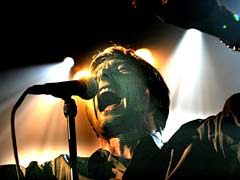 Brett Anderson